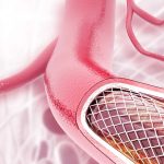 <h1>The Evolving World of Custom PTFE Tubing: A Smart Solution for Modern Needs</h1>